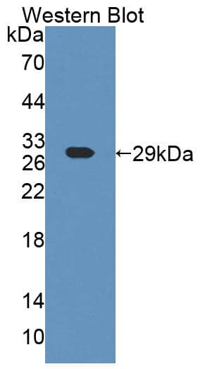 Western Blot ART4 Antibody