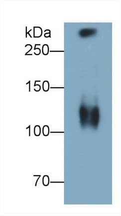 Western Blot: MUC5B Antibody (D7) [NBP3-41189] - Sample: Human Saliva Primary Ab: 1ug/ml NBP3-41189; Second Ab: 0.2ug/mL HRP-Linked Caprine Anti-Mouse IgG Polyclonal Antibody