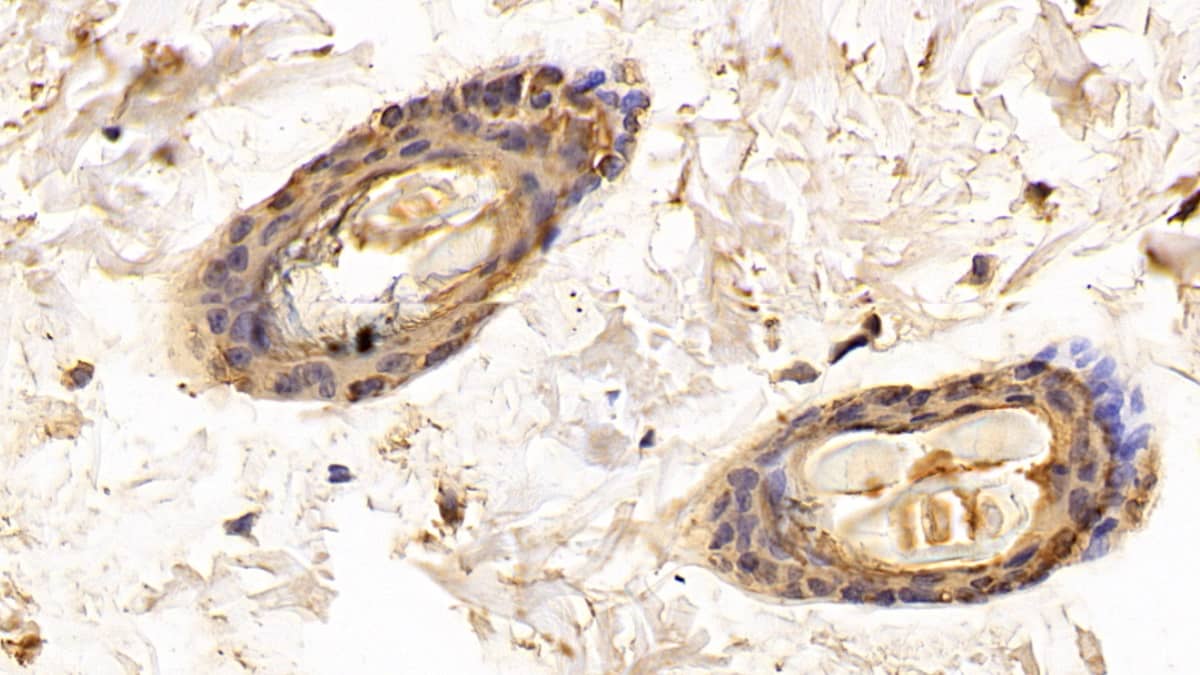 Immunohistochemistry-Paraffin: Galectin-7 Antibody (E4) [NBP3-41193] - DAB staining on IHC-P; Sample: Rat Skin Tissue; Primary Ab: 30ug/ml NBP3-41193; Second Ab: 2ug/mL HRP-Linked Caprine Anti-Mouse IgG Polyclonal Antibody