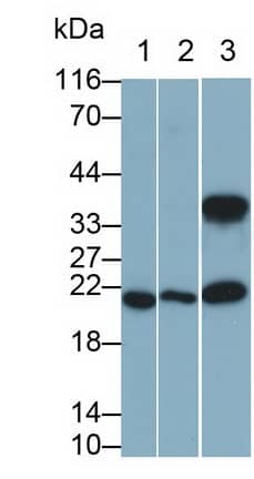 Western Blot: IL-11 Antibody (C2) [NBP3-41194] - Sample: Lane1: Porcine Skin lysate; Lane2: U2OS cell lysate; Lane3: A431 cell lysate Primary Ab: 0.5ug/ml NBP3-41194; Second Ab: 0.2ug/mL HRP-Linked Caprine Anti-Mouse IgG Polyclonal Antibody