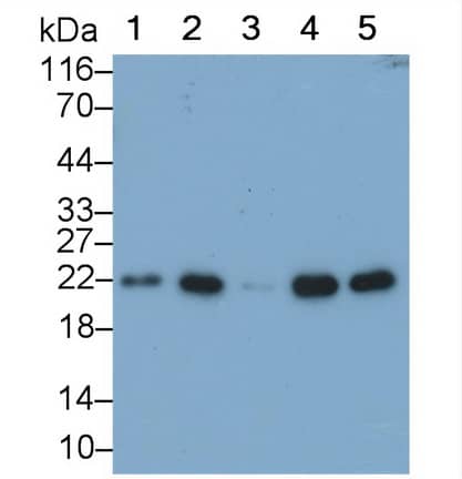 Western Blot: BID Antibody (C1) [NBP3-41195] - Sample: Lane1: Human Lung lysate; Lane2: A431 cell lysate; Lane3: MCF7 cell lysate; Lane4: Hela cell lysate; Lane5: Jurkat cell lysatePrimary Ab: 0.2ug/ml NBP3-41195; Second Ab: 0.2ug/mL HRP-Linked Caprine Anti-Mouse IgG Polyclonal Antibody