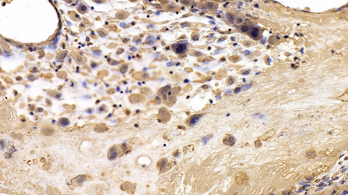 Immunohistochemistry-Paraffin: TIMP-3 Antibody (C2) [NBP3-41196] - DAB staining on IHC-P; Sample: Human Placenta Tissue; Primary Ab: 30ug/ml NBP3-41196; Second Ab: 2ug/mL HRP-Linked Caprine Anti-Mouse IgG Polyclonal Antibody