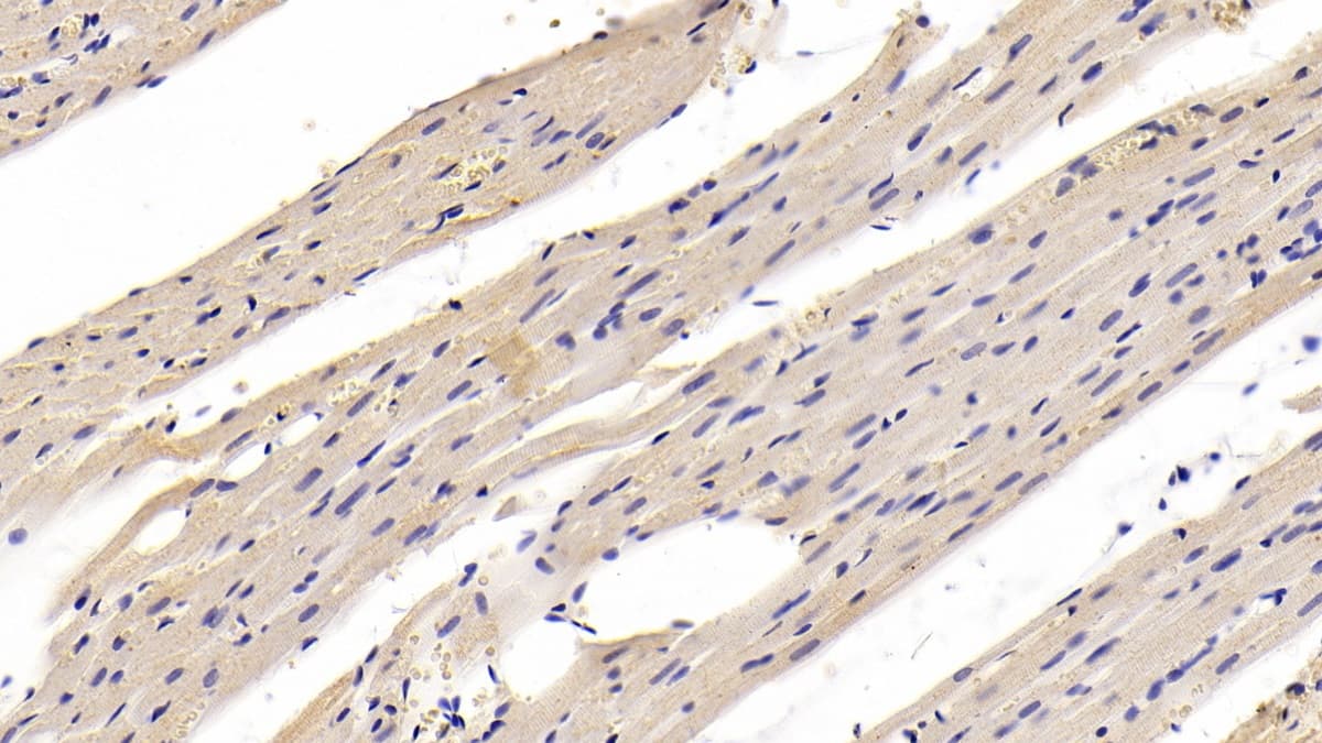 Immunohistochemistry-Paraffin: Myosin Heavy Chain 1 Antibody (C1) [NBP3-41197] - DAB staining on IHC-P; Sample: Rat Cardiac Muscle Tissue; Primary Ab: 30ug/ml NBP3-41197; Second Ab: 2ug/mL HRP-Linked Caprine Anti-Mouse IgG Polyclonal Antibody