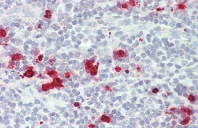 Immunohistochemistry-Paraffin: Granzyme M Antibody (D1) [NBP3-41198] - Vector Red staining on IHC-P; Samples: Human Tonsil Tissue; Primary Ab: 10ug/ml NBP3-41198; Second Ab: 2ug/mL HRP-Linked Caprine Anti-Mouse IgG Monoclonal Antibody
