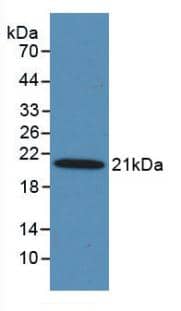 Western Blot: MASP2 Antibody (C3) [NBP3-41199] - Sample: Recombinant MASP2, Human.