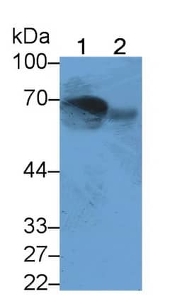 Western Blot: MASP2 Antibody (C3) [NBP3-41199] - Sample: Lane1: Human Serum; Lane2: Human Urine Primary Ab: 5ug/ml NBP3-41199; Second Ab: 0.2ug/mL HRP-Linked Caprine Anti-Mouse IgG Polyclonal Antibody