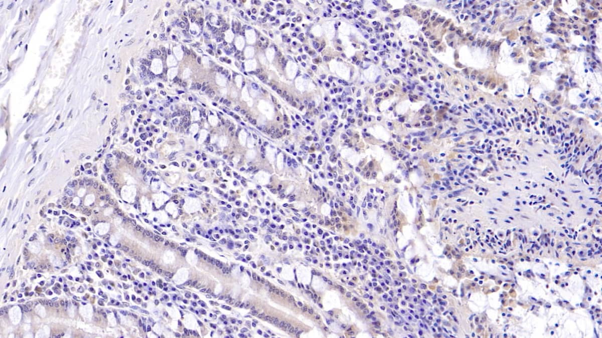 Immunohistochemistry-Paraffin: MUC5B Antibody (C1) [NBP3-41205] - DAB staining on IHC-P; Sample: Human Small intestine Tissue; Primary Ab: 30ug/ml NBP3-41205; Second Ab: 2ug/mL HRP-Linked Caprine Anti-Mouse IgG Polyclonal Antibody