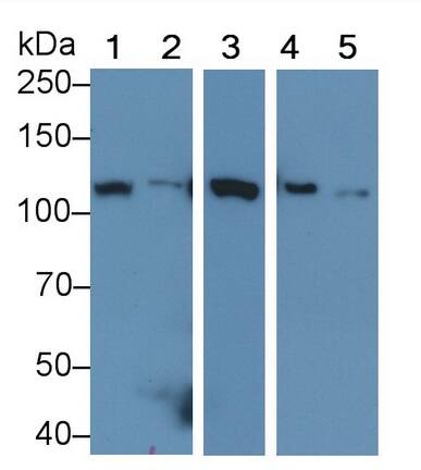 Western Blot: Hexokinase 1 Antibody (C4) [NBP3-41206] - Sample: Lane1: Rat Heart lysate; Lane2: Rat Lung lysate; Lane3: Rat Cerebrum lysate; Lane4: Jurkat cell lysate; Lane5: A549 cell lysate Primary Ab: 0.5ug/ml NBP3-41206; Second Ab: 0.2ug/mL HRP-Linked Caprine Anti-Mouse IgG Polyclonal Antibody