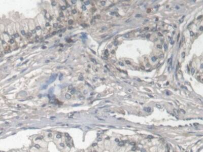 Immunohistochemistry-Paraffin: Fibulin 1 Antibody (C6) [NBP3-41208] - DAB staining on IHC-P; Samples: Human Prostate Tissue; Primary Ab: 30ug/ml NBP3-41208; Second Ab: 2ug/mL HRP-Linked Caprine Anti-Mouse IgG Polyclonal Antibody