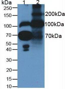 Western Blot: Fibulin 1 Antibody (C6) [NBP3-41208] - Samples. Lane1: Human Serum; Lane2: Rat Placenta Tissue; 