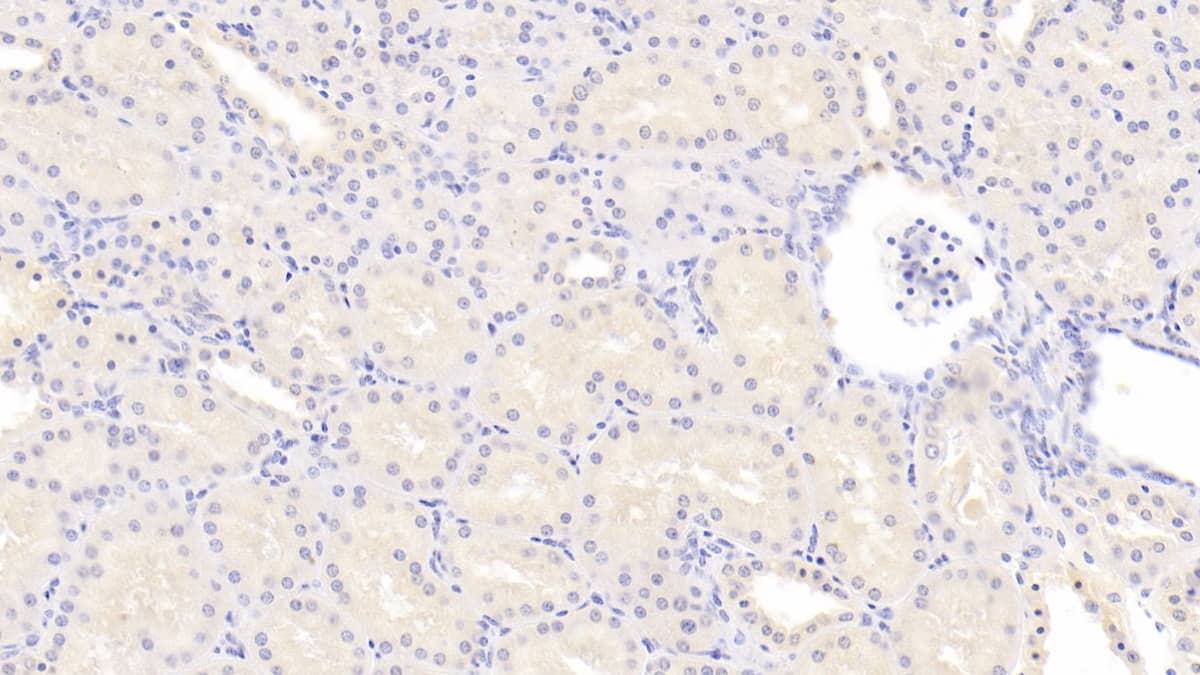 Immunohistochemistry-Paraffin: 15-Lipoxygenase 1 Antibody (C2) [NBP3-41210] - DAB staining on IHC-P; Sample: Human Kidney Tissue; Primary Ab: 30ug/ml NBP3-41210; Second Ab: 2ug/mL HRP-Linked Caprine Anti-Mouse IgG Polyclonal Antibody