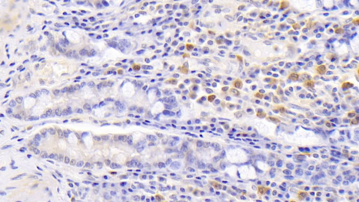 Immunohistochemistry-Paraffin: 15-Lipoxygenase 1 Antibody (C2) [NBP3-41210] - DAB staining on IHC-P; Sample: Human Small intestine Tissue; Primary Ab: 30ug/ml NBP3-41210; Second Ab: 2ug/mL HRP-Linked Caprine Anti-Mouse IgG Polyclonal Antibody