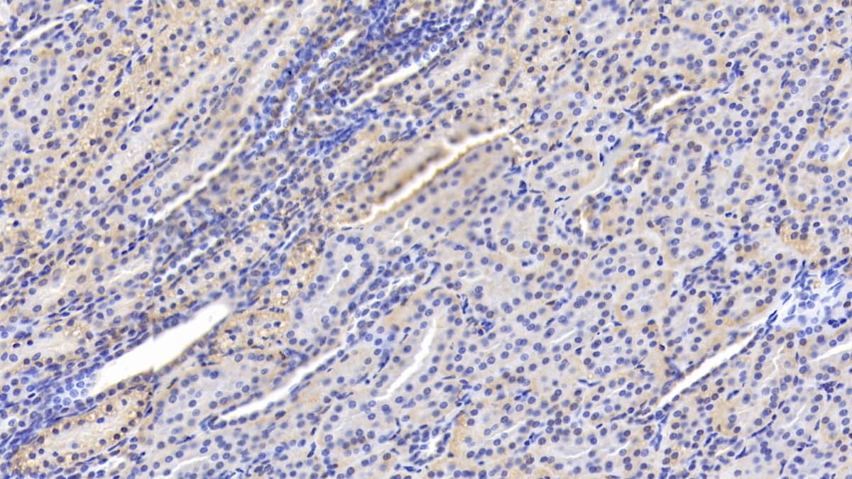 Immunohistochemistry-Paraffin: 15-Lipoxygenase 1 Antibody (D6) [NBP3-41211] - DAB staining on IHC-P; Sample: Human Kidney Tissue; Primary Ab: 20ug/ml NBP3-41211; Second Ab: 2ug/mL HRP-Linked Caprine Anti-Mouse IgG Polyclonal Antibody