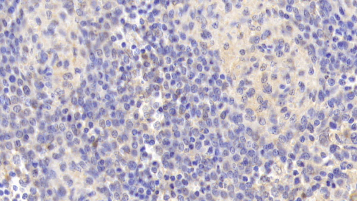 Immunohistochemistry-Paraffin: 15-Lipoxygenase 1 Antibody (D6) [NBP3-41211] - DAB staining on IHC-P; Sample: Human Spleen Tissue; Primary Ab: 20ug/ml NBP3-41211; Second Ab: 2ug/mL HRP-Linked Caprine Anti-Mouse IgG Polyclonal Antibody