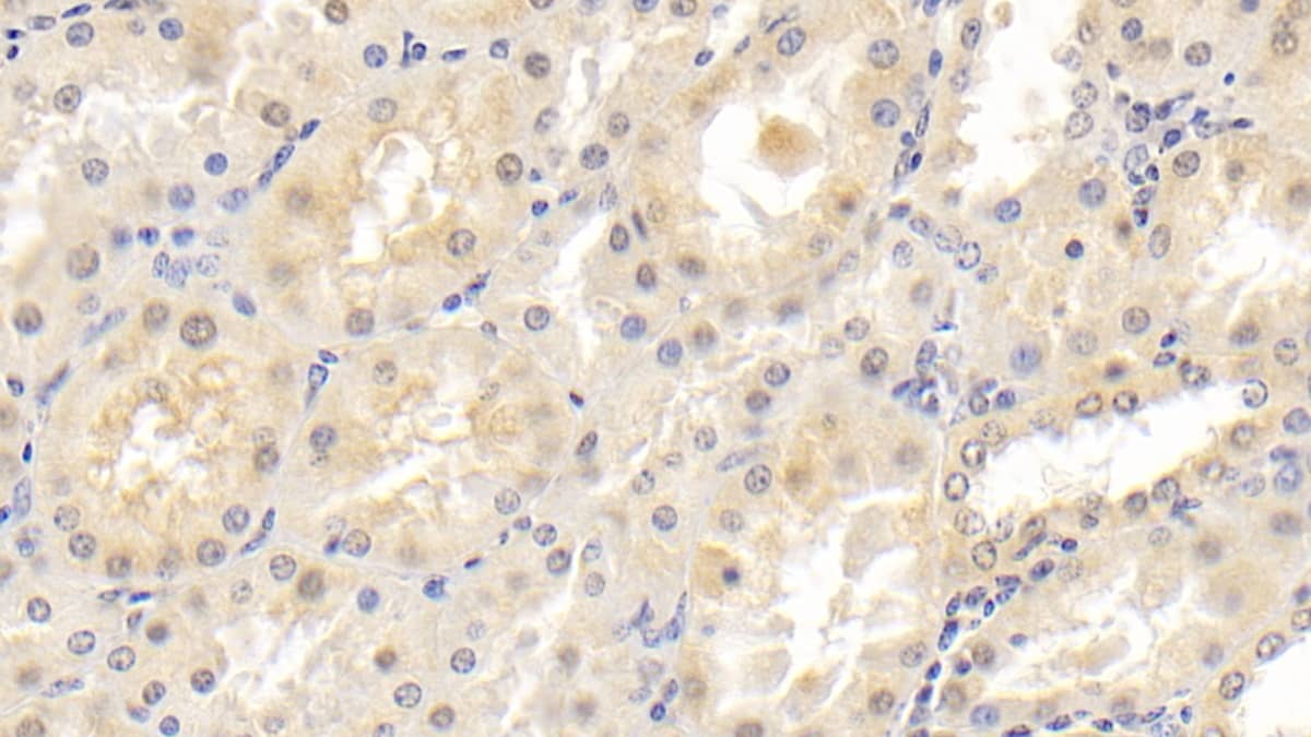 Immunohistochemistry-Paraffin: NT-3 Antibody (D1) [NBP3-41212] - DAB staining on IHC-P; Sample: Human Kidney Tissue; Primary Ab: 30ug/ml NBP3-41212; Second Ab: 2ug/mL HRP-Linked Caprine Anti-Mouse IgG Polyclonal Antibody