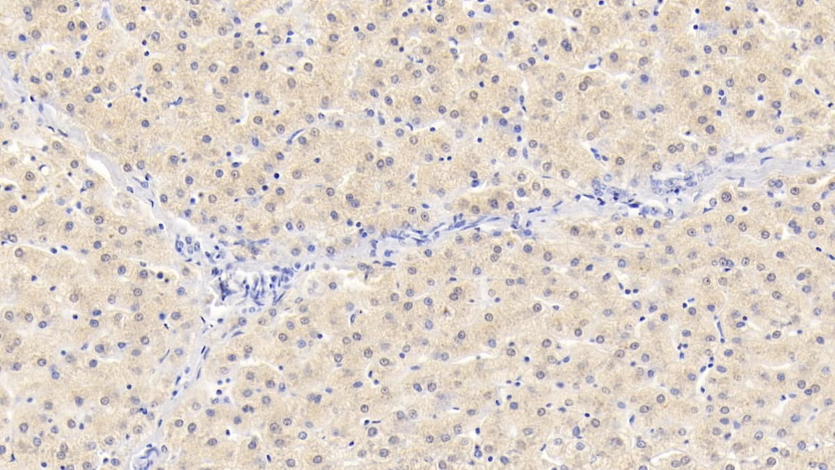 Immunohistochemistry-Paraffin: NT-3 Antibody (D1) [NBP3-41212] - DAB staining on IHC-P; Sample: Human Liver Tissue; Primary Ab: 30ug/ml NBP3-41212; Second Ab: 2ug/mL HRP-Linked Caprine Anti-Mouse IgG Polyclonal Antibody