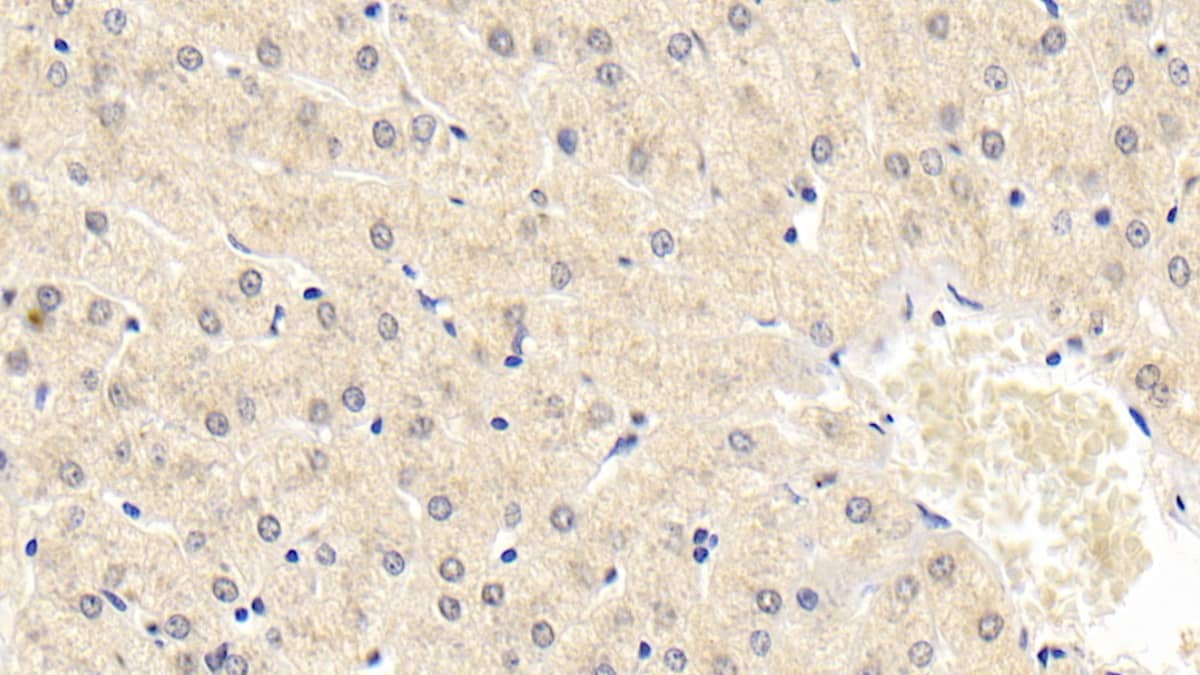 Immunohistochemistry-Paraffin: NT-3 Antibody (D3) [NBP3-41213] - DAB staining on IHC-P; Sample: Human Liver Tissue; Primary Ab: 30ug/ml NBP3-41213; Second Ab: 2ug/mL HRP-Linked Caprine Anti-Mouse IgG Polyclonal Antibody