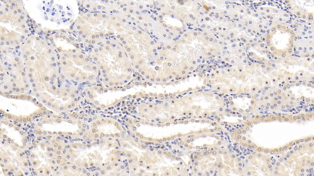 Immunohistochemistry-Paraffin: NT-3 Antibody (D3) [NBP3-41213] - DAB staining on IHC-P; Sample: Human Kidney Tissue; Primary Ab: 30ug/ml NBP3-41213; Second Ab: 2ug/mL HRP-Linked Caprine Anti-Mouse IgG Polyclonal Antibody