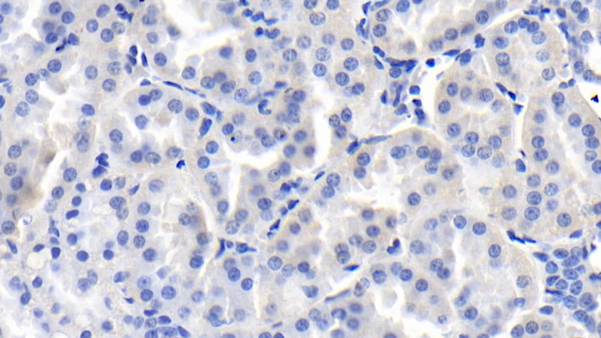 Immunohistochemistry-Paraffin: FGF-9 Antibody (E8) [NBP3-41214] - DAB staining on IHC-P; Sample: Human Kidney Tissue; Primary Ab: 20ug/ml NBP3-41214; Second Ab: 2ug/mL HRP-Linked Caprine Anti-Mouse IgG Polyclonal Antibody