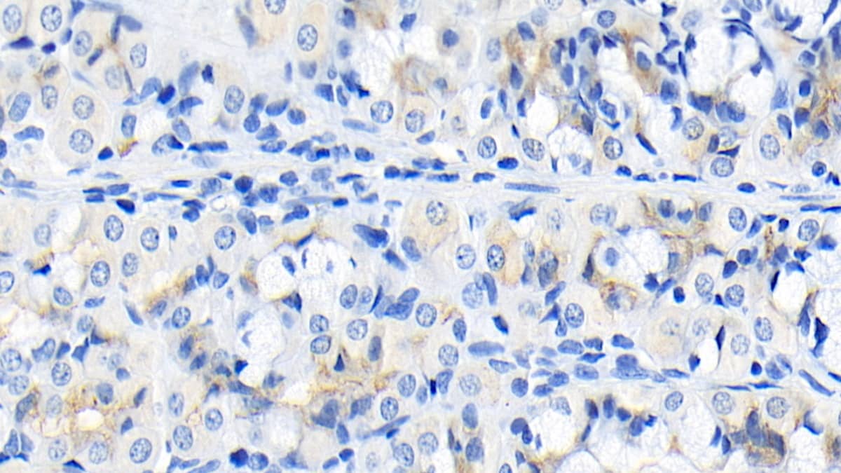 Immunohistochemistry-Paraffin: FGF-9 Antibody (E8) [NBP3-41214] - DAB staining on IHC-P; Sample: Human Stomach Tissue; Primary Ab: 20ug/ml NBP3-41214; Second Ab: 2ug/mL HRP-Linked Caprine Anti-Mouse IgG Polyclonal Antibody