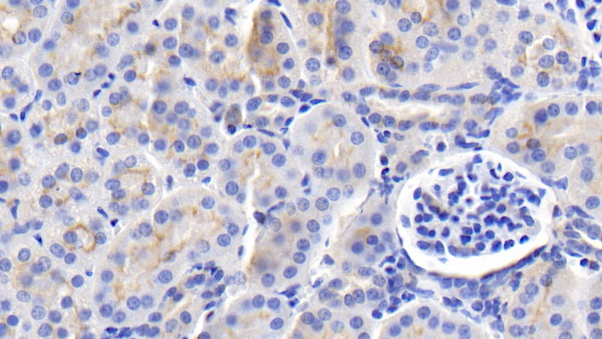 Immunohistochemistry-Paraffin: FGF-9 Antibody (E16) [NBP3-41215] - DAB staining on IHC-P; Sample: Human Kidney Tissue; Primary Ab: 20ug/ml NBP3-41215; Second Ab: 2ug/mL HRP-Linked Caprine Anti-Mouse IgG Polyclonal Antibody