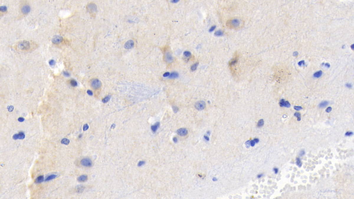 Immunohistochemistry-Paraffin: FGF-9 Antibody (E16) [NBP3-41215] - DAB staining on IHC-P; Sample: Human Cerebrum Tissue; Primary Ab: 20ug/ml NBP3-41215; Second Ab: 2ug/mL HRP-Linked Caprine Anti-Mouse IgG Polyclonal Antibody