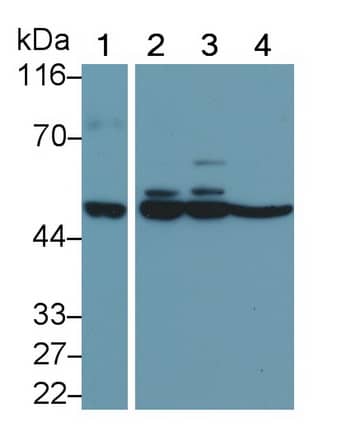 Western Blot MMP-11 Antibody (D1)