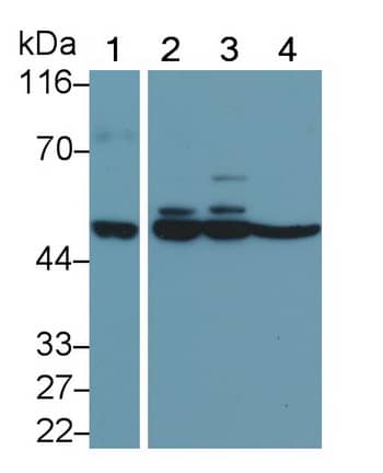 Western Blot: MMP-11 Antibody (D1) [NBP3-41217] - Sample: Lane1: Human Placenta lysate; Lane2: T-47D cell lysate; Lane3: Hela cell lysate; Lane4: MDA-MB-435S cell lysate Primary Ab: 1ug/ml NBP3-41217; Second Ab: 0.2ug/mL HRP-Linked Caprine Anti-Mouse IgG Polyclonal Antibody