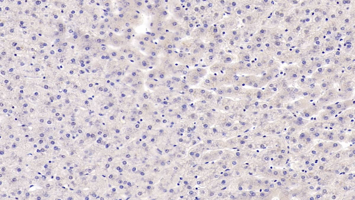 Immunohistochemistry-Paraffin: ERAF Antibody (C2) [NBP3-41218] - DAB staining on IHC-P; Sample: Human Liver Tissue; Primary Ab: 40ug/ml NBP3-41218; Second Ab: 2ug/mL HRP-Linked Caprine Anti-Mouse IgG Polyclonal Antibody