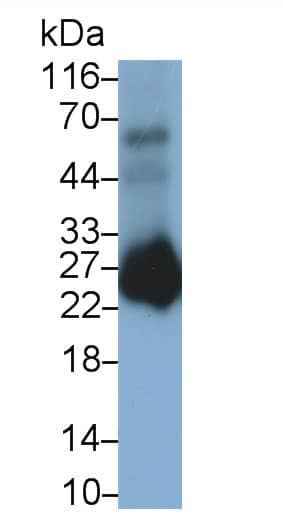 Western Blot: PGD2 Synthase/PTGDS Antibody (C2) [NBP3-41219] - Sample: Rat Colon lysate Primary Ab: 0.3ug/ml NBP3-41219; Second Ab: 0.2ug/mL HRP-Linked Caprine Anti-Mouse IgG Polyclonal Antibody