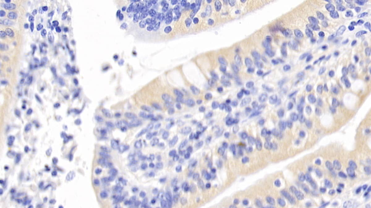 Immunohistochemistry-Paraffin: Inhibin beta A Antibody (C3) [NBP3-41220] - DAB staining on IHC-P; Sample: Human Small intestine Tissue; Primary Ab: 20ug/ml NBP3-41220; Second Ab: 2ug/mL HRP-Linked Caprine Anti-Mouse IgG Polyclonal Antibody