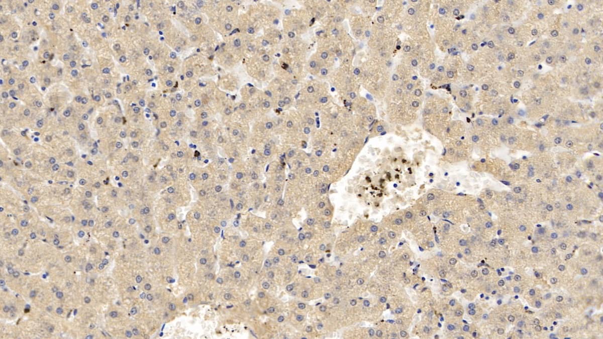 Immunohistochemistry-Paraffin: Apolipoprotein C1 Antibody (C14) [NBP3-41223] - DAB staining on IHC-P; Sample: Human Liver Tissue; Primary Ab: 10ug/ml NBP3-41223; Second Ab: 2ug/mL HRP-Linked Caprine Anti-Mouse IgG Polyclonal Antibody