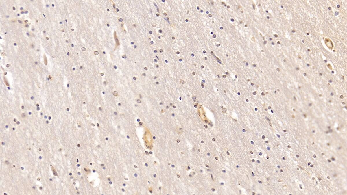 Immunohistochemistry-Paraffin: MOG Antibody (D8) [NBP3-41224] - DAB staining on IHC-P; Sample: Human Cerebrum Tissue; Primary Ab: 20ug/ml NBP3-41224; Second Ab: 2ug/mL HRP-Linked Caprine Anti-Mouse IgG Polyclonal Antibody
