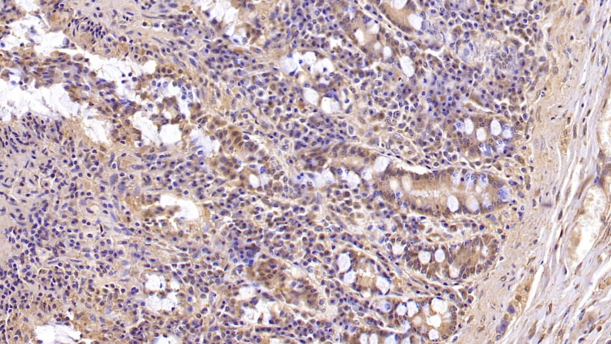 Immunohistochemistry-Paraffin: MUC5B Antibody (C6) [NBP3-41225] - DAB staining on IHC-P; Sample: Human Small intestine Tissue; Primary Ab: 30ug/ml NBP3-41225; Second Ab: 2ug/mL HRP-Linked Caprine Anti-Mouse IgG Polyclonal Antibody