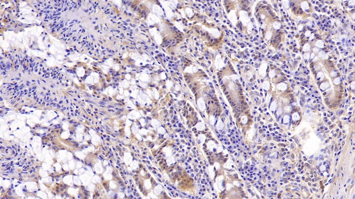 Immunohistochemistry-Paraffin: MUC5B Antibody (C8) [NBP3-41226] - DAB staining on IHC-P; Sample: Human Small intestine Tissue; Primary Ab: 30ug/ml NBP3-41226; Second Ab: 2ug/mL HRP-Linked Caprine Anti-Mouse IgG Polyclonal Antibody