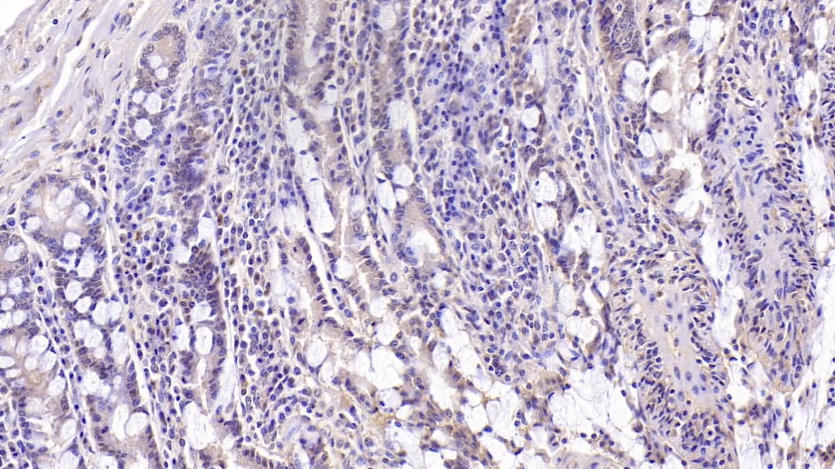 Immunohistochemistry-Paraffin: MUC5B Antibody (C9) [NBP3-41227] - DAB staining on IHC-P; Sample: Human Small intestine Tissue; Primary Ab: 30ug/ml NBP3-41227; Second Ab: 2ug/mL HRP-Linked Caprine Anti-Mouse IgG Polyclonal Antibody