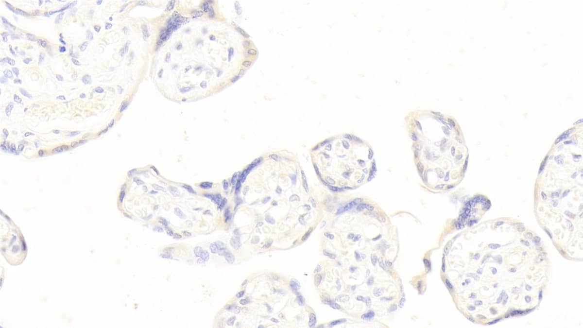 Immunohistochemistry-Paraffin: Pappalysin-1/PAPP-A Antibody (H6) [NBP3-41228] - DAB staining on IHC-P; Sample: Human Placenta Tissue; Primary Ab: 20ug/ml NBP3-41228; Second Ab: 2ug/mL HRP-Linked Caprine Anti-Mouse IgG Polyclonal Antibody