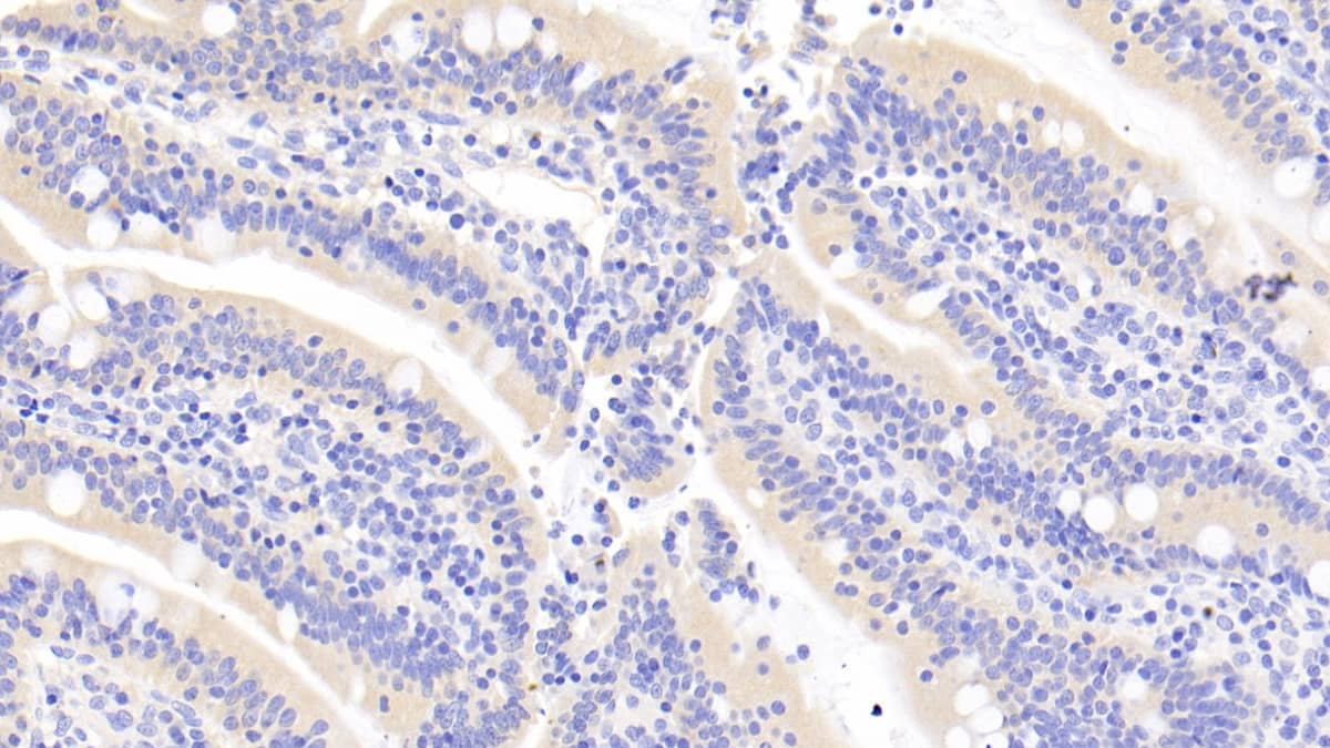 Immunohistochemistry-Paraffin: RNASE3 Antibody (C2) [NBP3-41229] - DAB staining on IHC-P; Sample: Human Small intestine Tissue; Primary Ab: 20ug/ml NBP3-41229; Second Ab: 2ug/mL HRP-Linked Caprine Anti-Mouse IgG Polyclonal Antibody