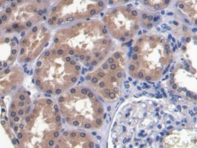 Immunohistochemistry-Paraffin: RNASE3 Antibody (C1) [NBP3-41230] - DAB staining on IHC-P; Sample: Human Kidney Tissue; Primary Ab: 20ug/ml NBP3-41230; Second Ab: 2ug/mL HRP-Linked Caprine Anti-Mouse IgG Polyclonal Antibody