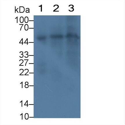 Western Blot: Reduced Folate Carrier/SLC19A1 Antibody (C1) [NBP3-41232] - Lane 1: Rat Uterus lysate; Lane 2: Rat Cerebrum lysate; Lane 3: Rat Cerebellum lysate Primary Ab: 2ug/ml NBP3-41232; Second Ab: 0.2ug/mL HRP-conjugated Rabbit Anti-Mouse IgG Polyclonal Antibody