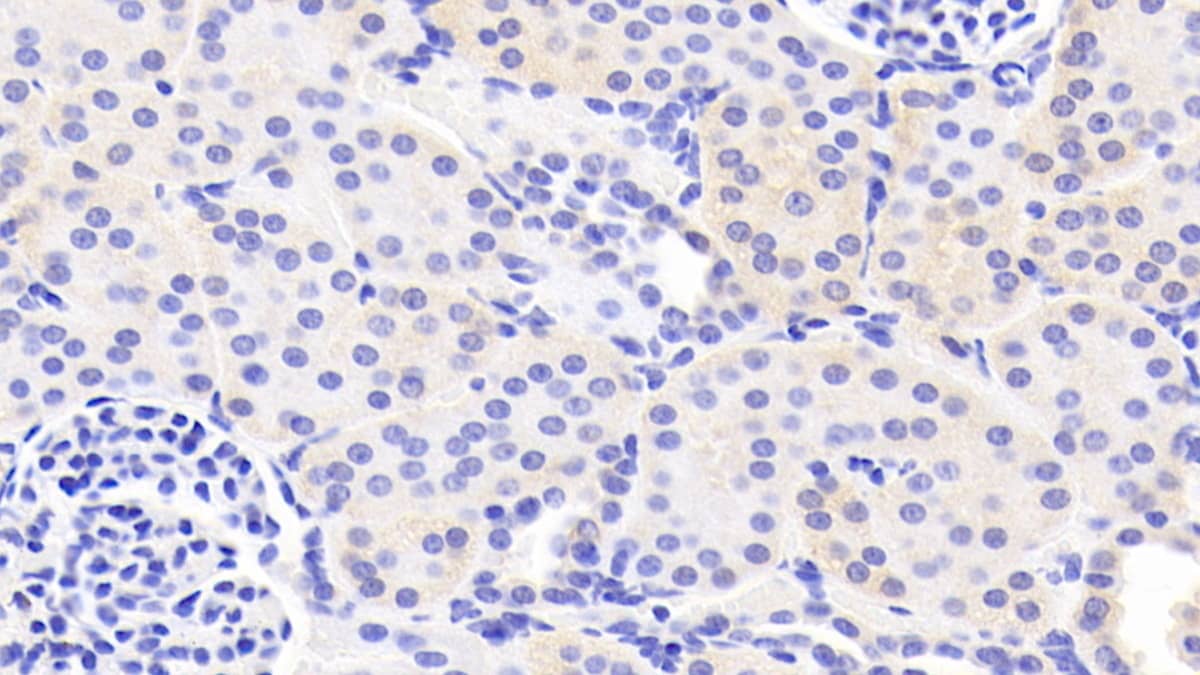 Immunohistochemistry-Paraffin: Laminin alpha 3 Antibody [NBP3-41233] - DAB staining on IHC-P; Samples: Human Kidney Tissue; Primary Ab: 20ug/ml NBP3-41233; Second Ab: 2ug/mL HRP-Linked Caprine Anti-Rabbit IgG Polyclonal Antibody