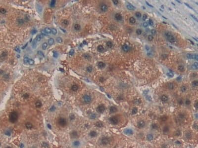 Immunohistochemistry-Paraffin: Laminin alpha 3 Antibody [NBP3-41233] - DAB staining on IHC-P; Samples: Human Kidney Tissue.