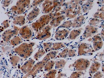 Immunohistochemistry-Paraffin: Collagen IV alpha3 Antibody [NBP3-41234] - DAB staining on IHC-P; Samples: Human Stomach Tissue; Primary Ab: 10ug/ml NBP3-41234; Second Ab: 2ug/mL HRP-Linked Caprine Anti-Rabbit IgG Polyclonal Antibody