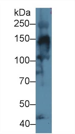 Western Blot: Collagen IV alpha3 Antibody [NBP3-41234] - Sample: Mouse Skeletal muscle lysate; Primary Ab: 1ug/ml NBP3-41234; Second Ab: 0.2ug/mL HRP-Linked Caprine Anti-Rabbit IgG Polyclonal Antibody