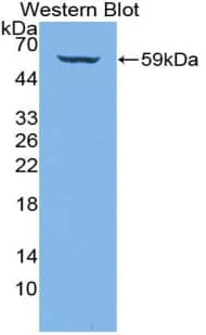 Western Blot: Collagen IV alpha3 Antibody [NBP3-41234] - Sample: Recombinant protein.