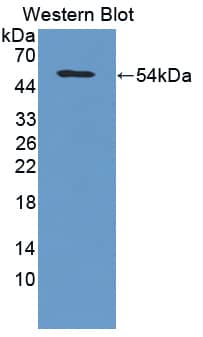 Western Blot Collagen V alpha 2 Antibody