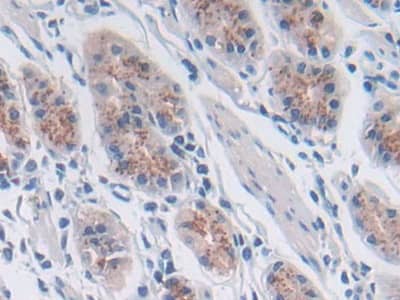 Immunohistochemistry-Paraffin: SNX13 Antibody [NBP3-41236] - DAB staining on IHC-P; Samples: Human Stomach Tissue; Primary Ab: 30ug/ml NBP3-41236; Second Ab: 2ug/mL HRP-Linked Caprine Anti-Rabbit IgG Polyclonal Antibody