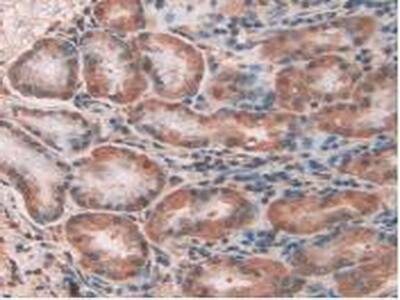 Immunohistochemistry-Paraffin: CLIC1 Antibody [NBP3-41237] - DAB staining on IHC-P; Samples: Human Kidney Tissue.