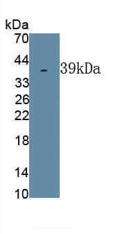 Western Blot: DSPP Antibody [NBP3-41238] - Recombinant Human DSPP