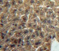 Immunohistochemistry-Paraffin: LACRT Antibody [NBP3-41240] - Used in DAB staining on fromalin fixed paraffin-embedded Liver tissue